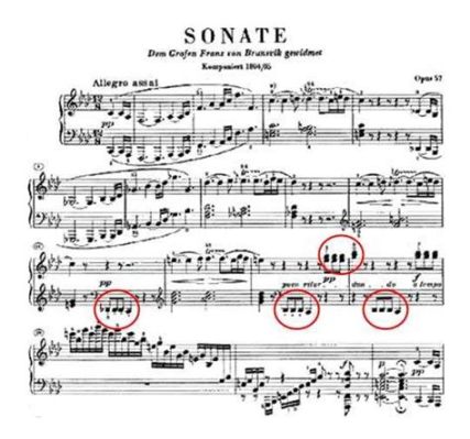  Appassionata Sonata: Ethereal Melancholy Meets Powerful Fortitude